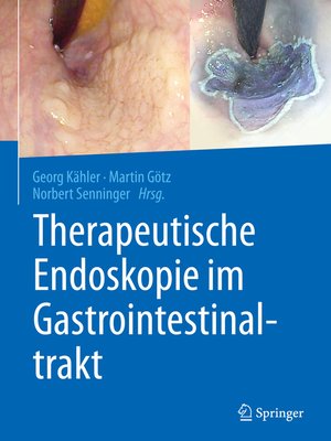 cover image of Therapeutische Endoskopie im Gastrointestinaltrakt